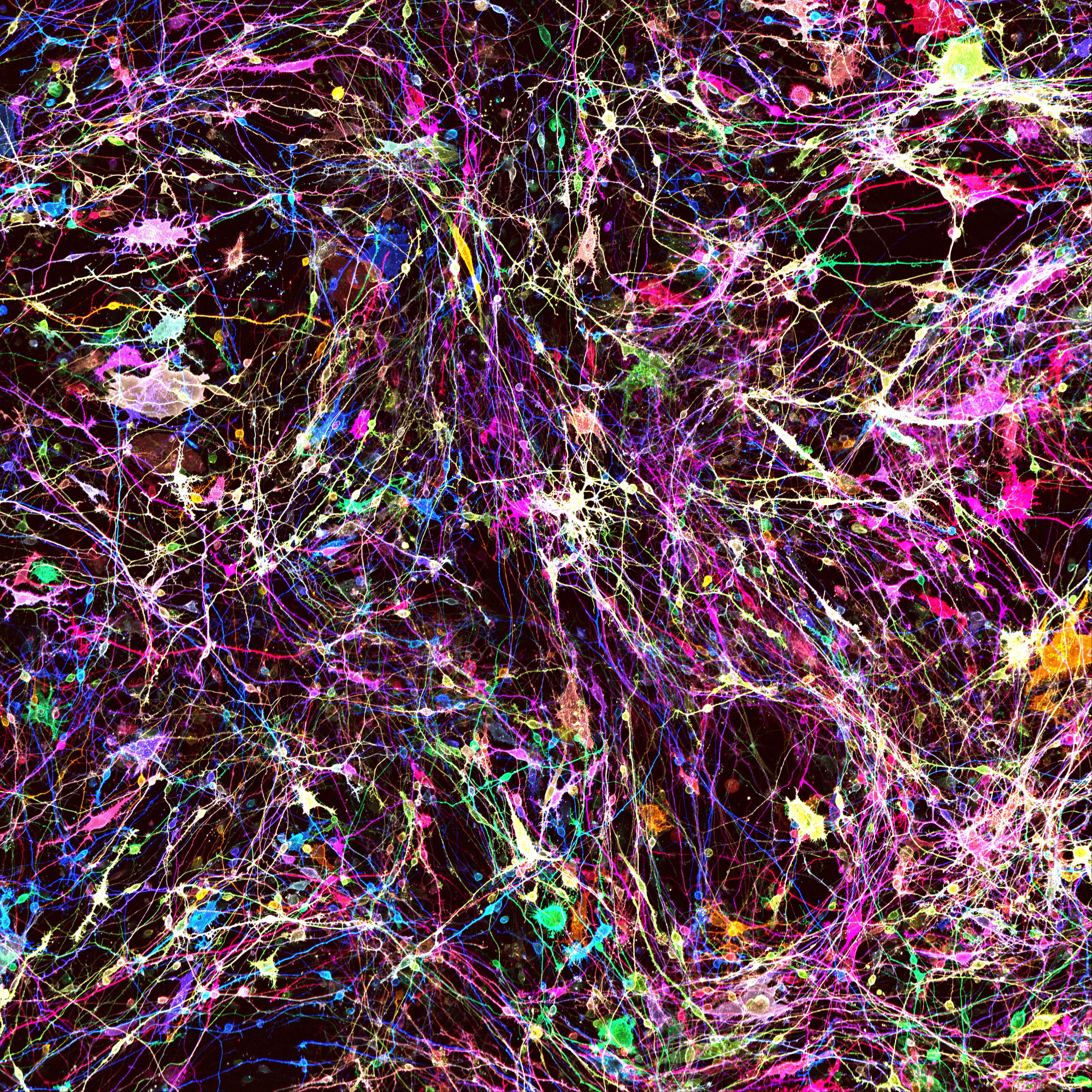 Screened neurons